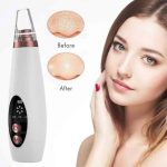Electric Blackhead Remover Vacuum with 5 Suction Heads
